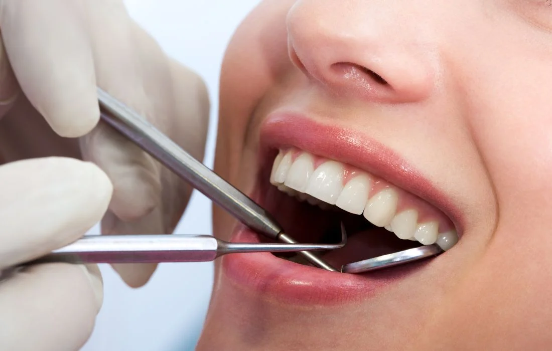 Teeth Cleaning (Scaling & Polishing)